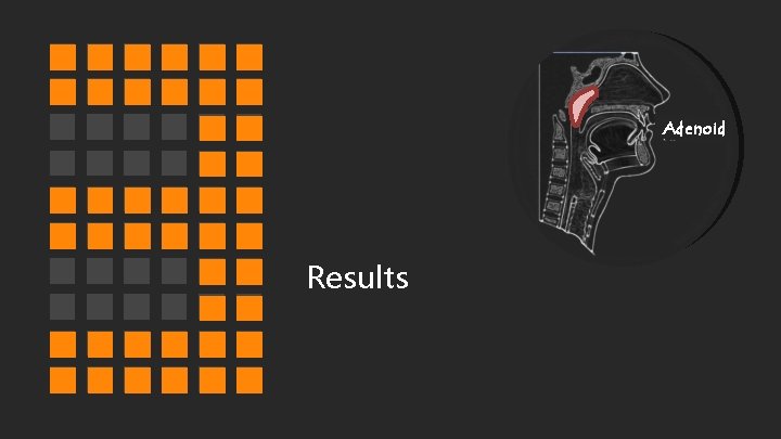 Adenoid Results 