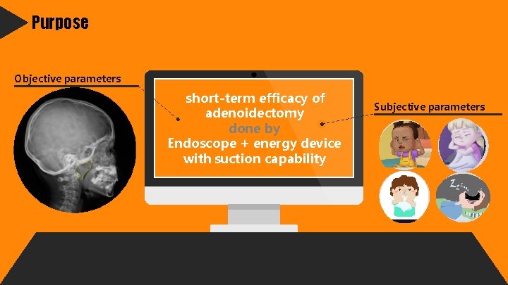 Purpose Objective parameters short-term efficacy of adenoidectomy done by Endoscope + energy device with