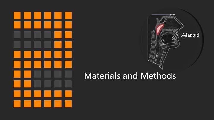 Adenoid Materials and Methods 