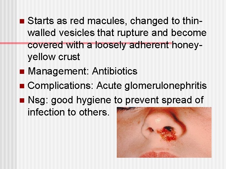 Starts as red macules, changed to thinwalled vesicles that rupture and become covered with