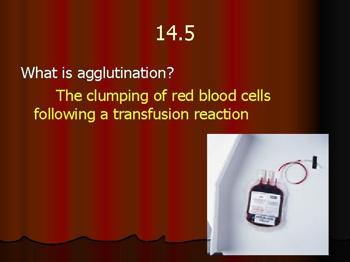 14. 5 What is agglutination? The clumping of red blood cells following a transfusion