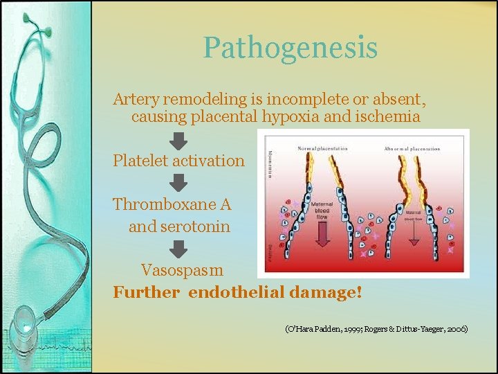 Pathogenesis Artery remodeling is incomplete or absent, causing placental hypoxia and ischemia Platelet activation