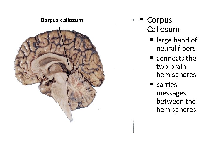 Corpus callosum § Corpus Callosum § large band of neural fibers § connects the