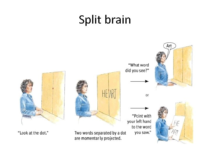 Split brain 