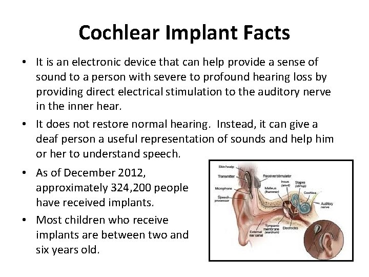 Cochlear Implant Facts • It is an electronic device that can help provide a
