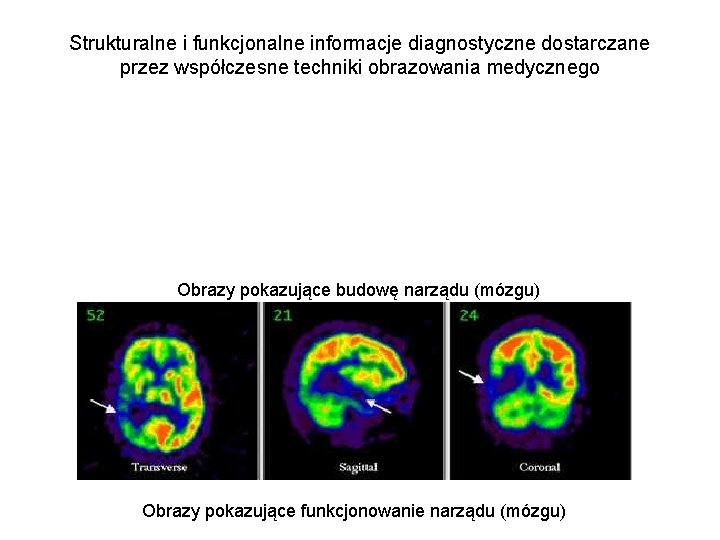 Strukturalne i funkcjonalne informacje diagnostyczne dostarczane przez współczesne techniki obrazowania medycznego Obrazy pokazujące budowę