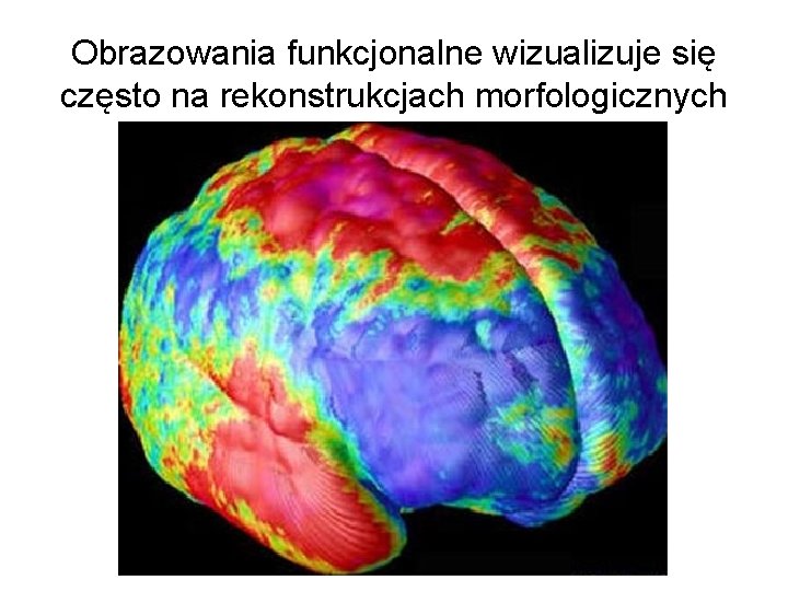 Obrazowania funkcjonalne wizualizuje się często na rekonstrukcjach morfologicznych 