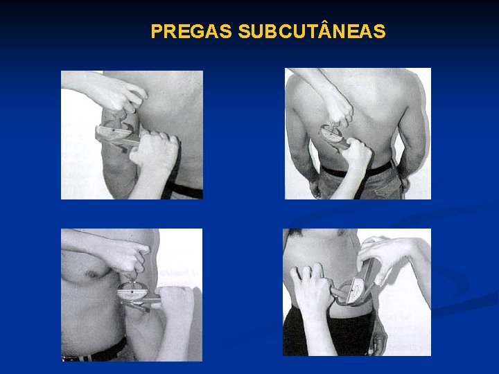 PREGAS SUBCUT NEAS 