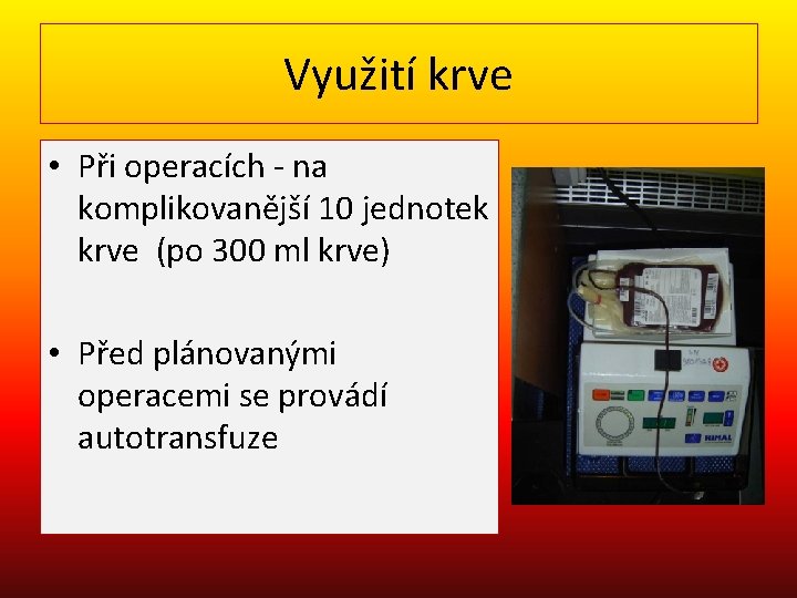 Využití krve • Při operacích - na komplikovanější 10 jednotek krve (po 300 ml