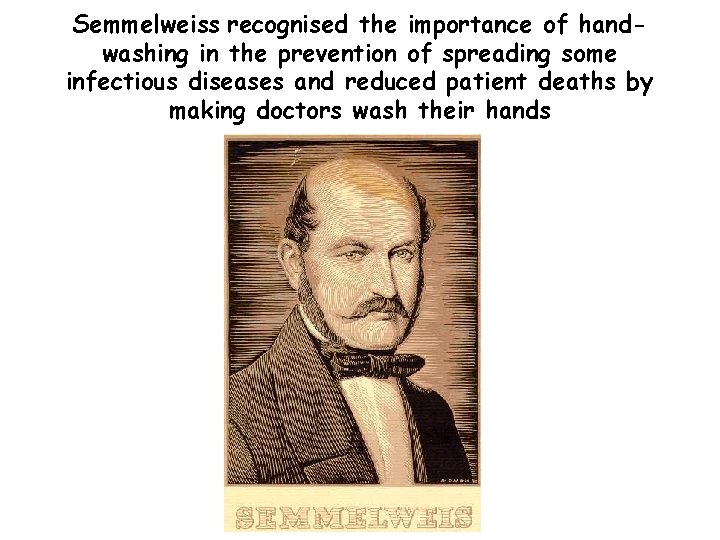 Semmelweiss recognised the importance of handwashing in the prevention of spreading some infectious diseases