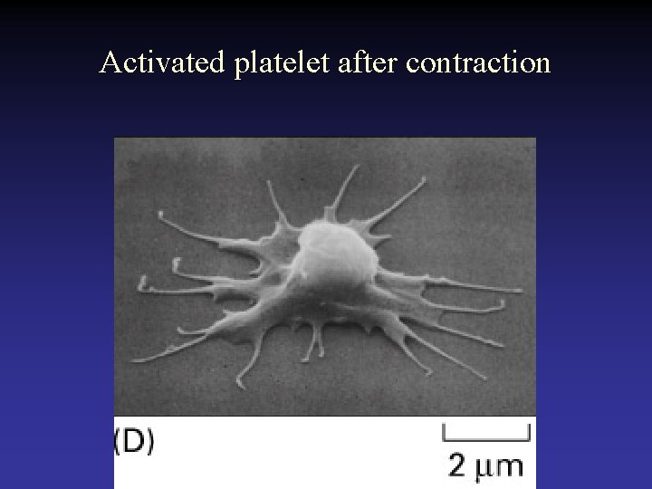 Activated platelet after contraction 