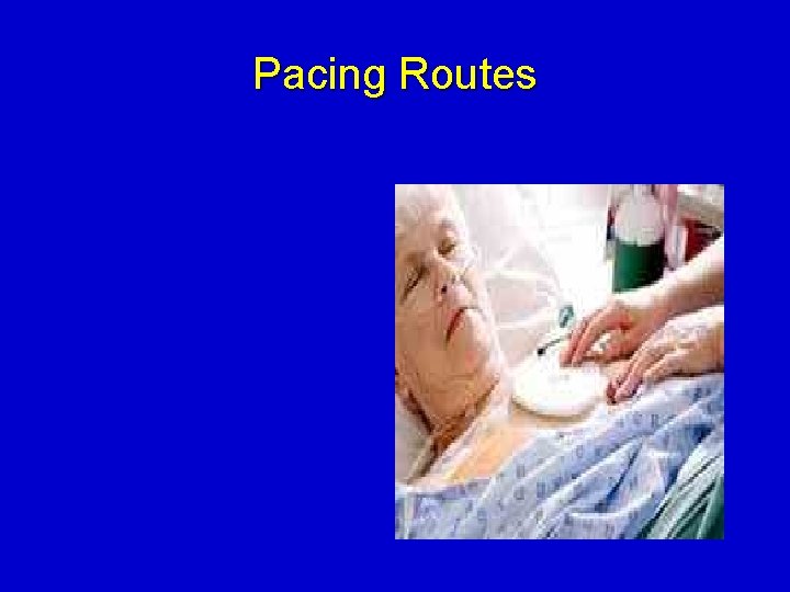 Pacing Routes 