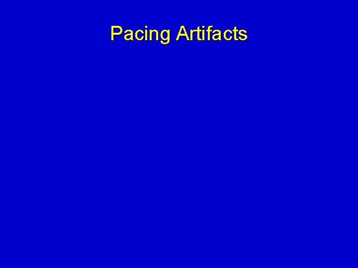 Pacing Artifacts 