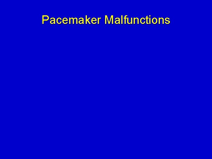 Pacemaker Malfunctions 