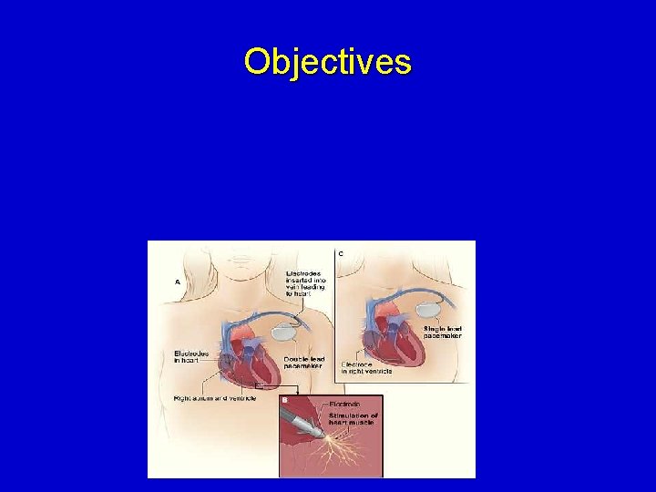 Objectives 