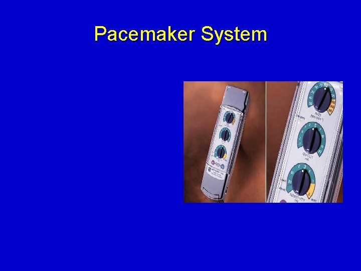 Pacemaker System 