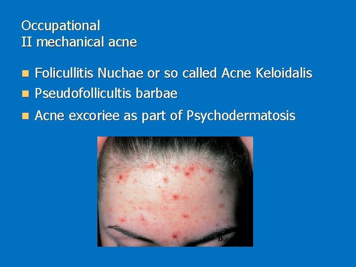 Occupational II mechanical acne Folicullitis Nuchae or so called Acne Keloidalis n Pseudofollicultis barbae