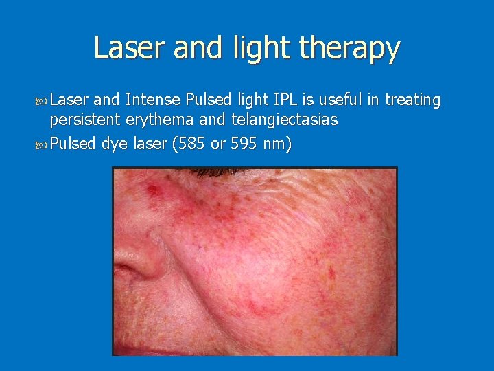 Laser and light therapy Laser and Intense Pulsed light IPL is useful in treating