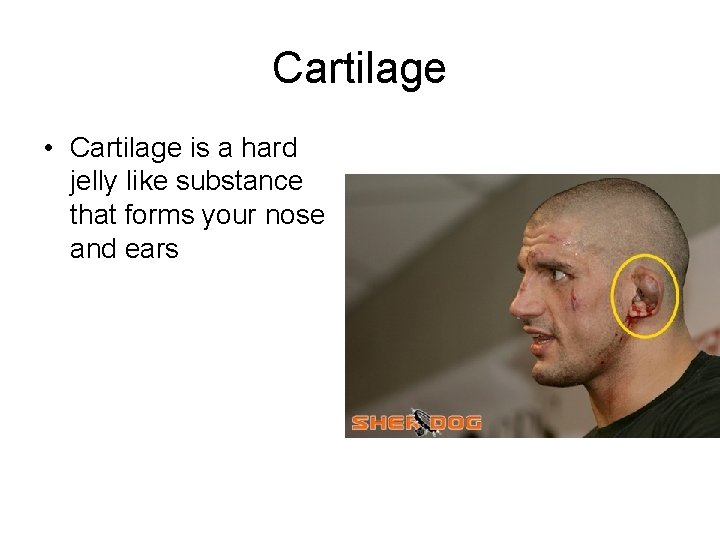Cartilage • Cartilage is a hard jelly like substance that forms your nose and