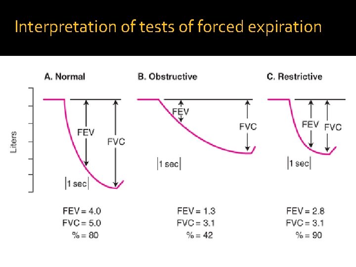 Interpretation of tests of forced expiration 