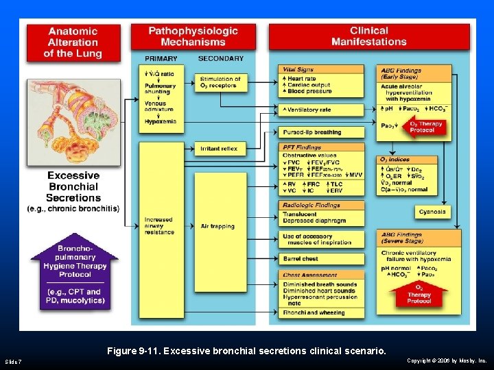 Figure 9 -11. Excessive bronchial secretions clinical scenario. Slide 7 Copyright © 2006 by