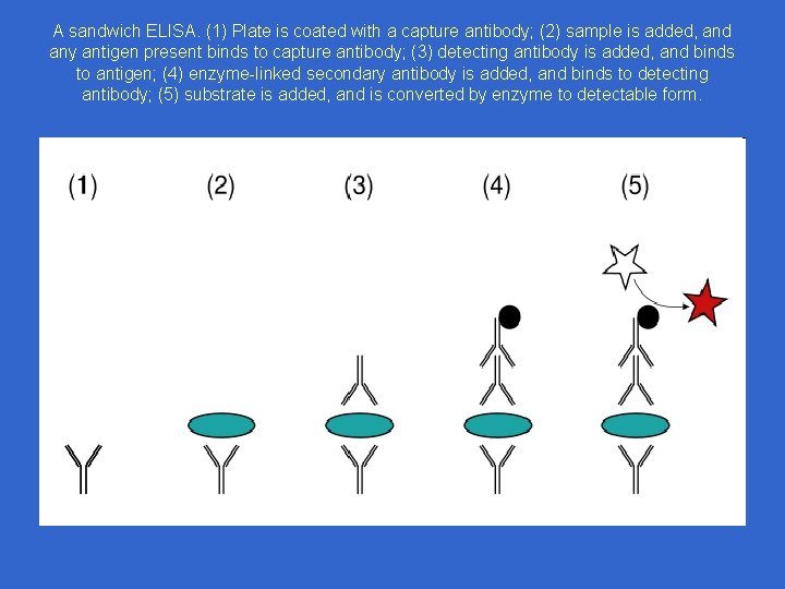 A sandwich ELISA. (1) Plate is coated with a capture antibody; (2) sample is