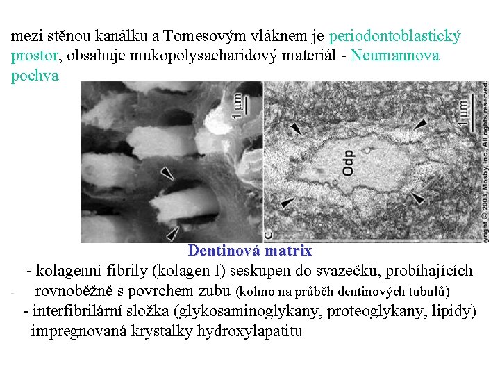 mezi stěnou kanálku a Tomesovým vláknem je periodontoblastický prostor, obsahuje mukopolysacharidový materiál - Neumannova