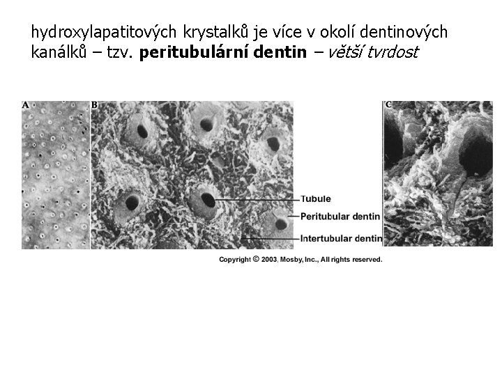 hydroxylapatitových krystalků je více v okolí dentinových kanálků – tzv. peritubulární dentin – větší