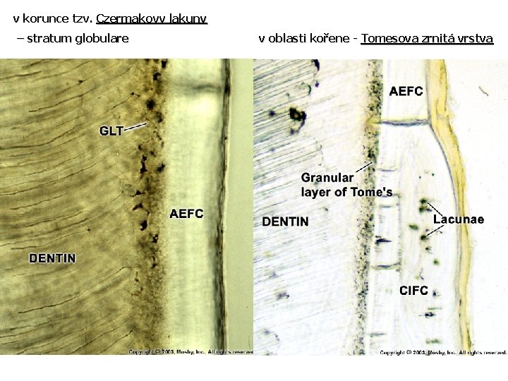 v korunce tzv. Czermakovy lakuny – stratum globulare v oblasti kořene - Tomesova zrnitá