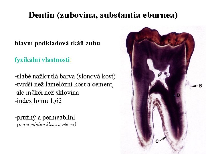Dentin (zubovina, substantia eburnea) hlavní podkladová tkáň zubu fyzikální vlastnosti: -slabě nažloutlá barva (slonová