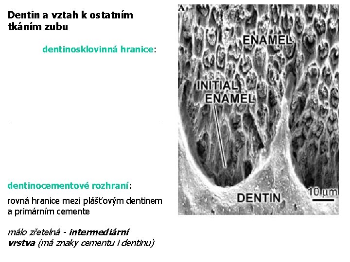 Dentin a vztah k ostatním tkáním zubu dentinosklovinná hranice: dentinocementové rozhraní: rovná hranice mezi