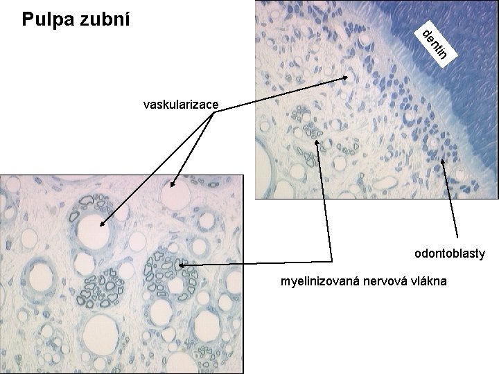 Pulpa zubní in nt de vaskularizace odontoblasty myelinizovaná nervová vlákna 