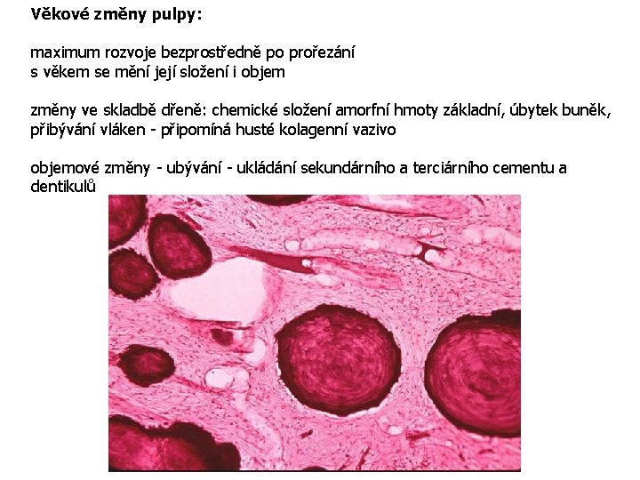 Věkové změny pulpy: maximum rozvoje bezprostředně po prořezání s věkem se mění její složení