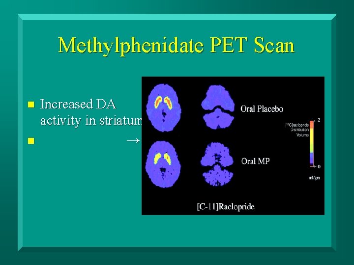 Methylphenidate PET Scan n n Increased DA activity in striatum → 