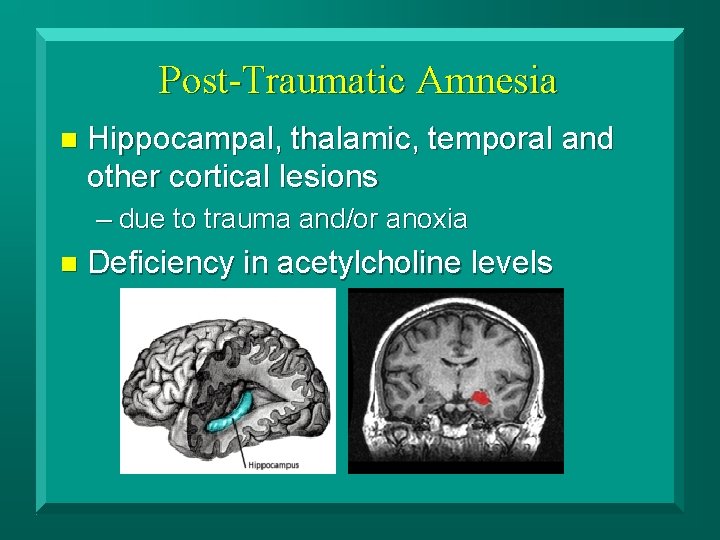 Post-Traumatic Amnesia n Hippocampal, thalamic, temporal and other cortical lesions – due to trauma