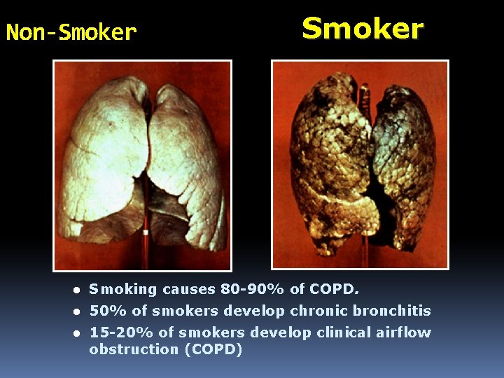 Non-Smoker l Smoking causes 80 -90% of COPD. l 50% of smokers develop chronic