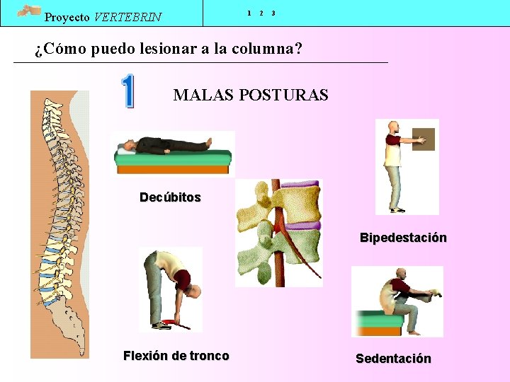 1 Proyecto VERTEBRIN 2 3 ¿Cómo puedo lesionar a la columna? MALAS POSTURAS Decúbitos