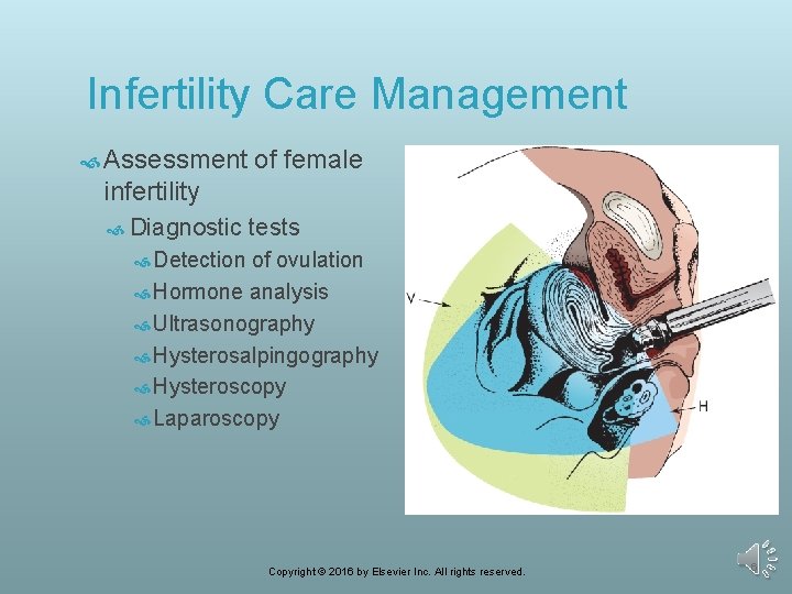 Infertility Care Management Assessment of female infertility Diagnostic tests Detection of ovulation Hormone analysis