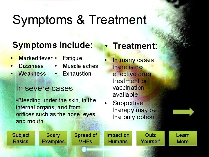 Symptoms & Treatment Symptoms Include: • Treatment: • Marked fever • Fatigue • Muscle