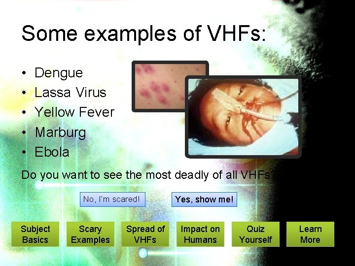 Some examples of VHFs: • • • Dengue Lassa Virus Yellow Fever Marburg Ebola