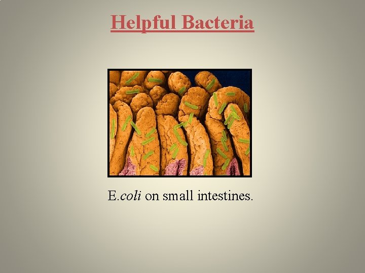 Helpful Bacteria E. coli on small intestines. 