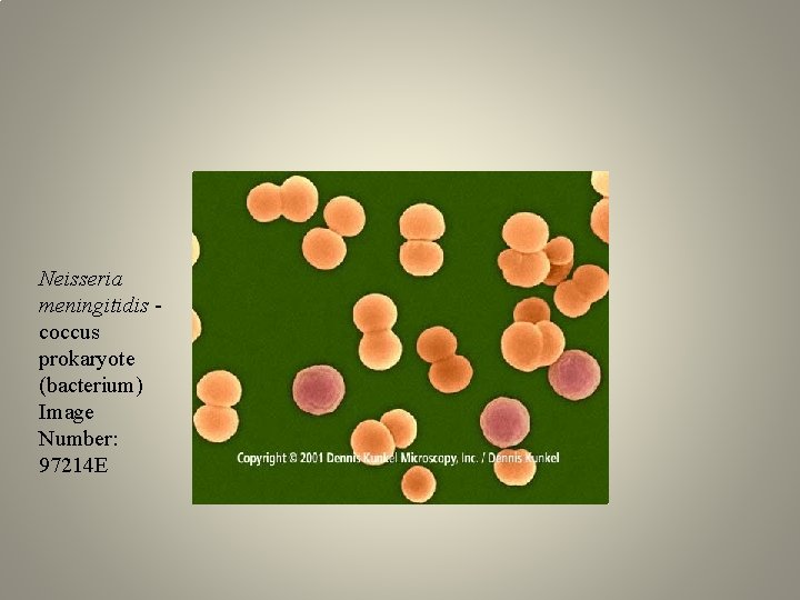 Neisseria meningitidis coccus prokaryote (bacterium) Image Number: 97214 E 