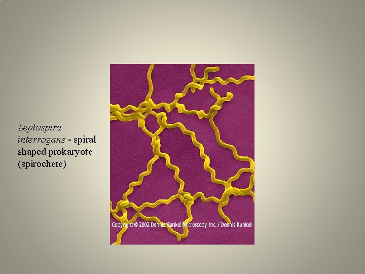 Leptospira interrogans - spiral shaped prokaryote (spirochete) 