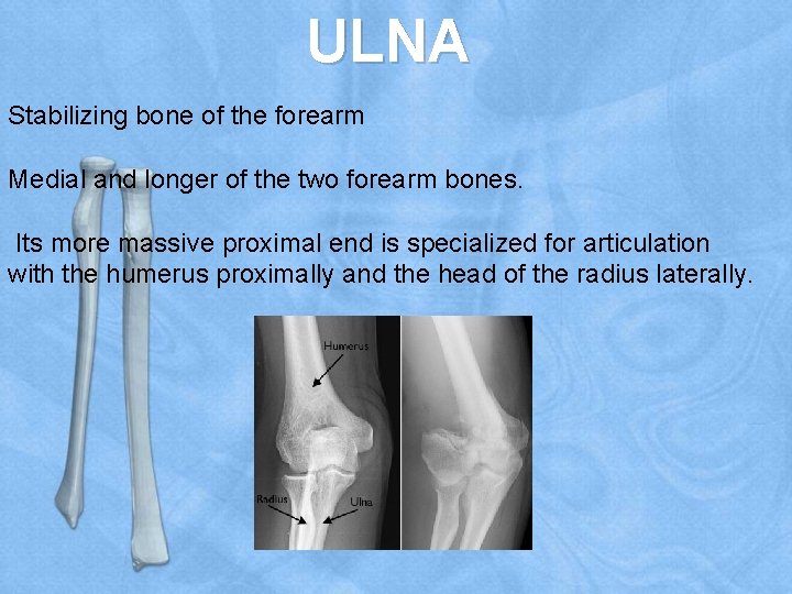 ULNA Stabilizing bone of the forearm Medial and longer of the two forearm bones.