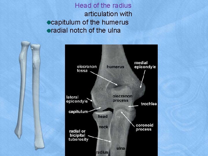 Head of the radius articulation with capitulum of the humerus radial notch of the