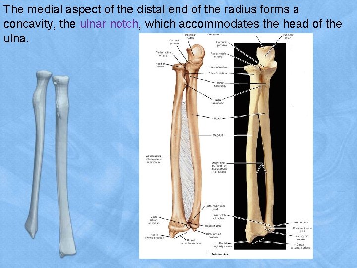The medial aspect of the distal end of the radius forms a concavity, the