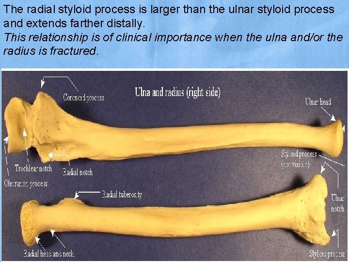 The radial styloid process is larger than the ulnar styloid process and extends farther