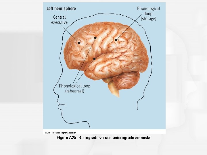 Figure 7. 25 Retrograde versus anterograde amnesia 