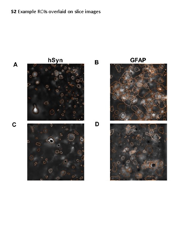 S 2 Example ROIs overlaid on slice images 