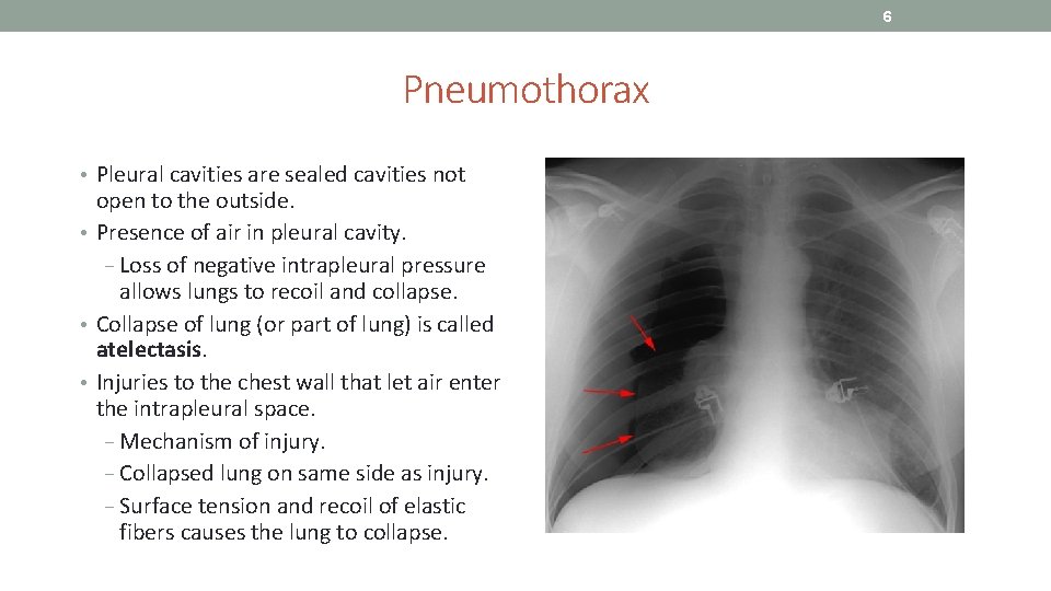 6 Pneumothorax • Pleural cavities are sealed cavities not open to the outside. •